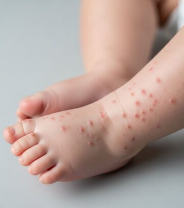 Comprehensive visual guide to Gianotti-Crosti syndrome with clinical images, symptoms, causes, and management in children.